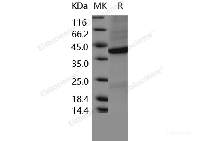 Recombinant Human FRZB / sFRP-3 Protein (His tag)-Elabscience