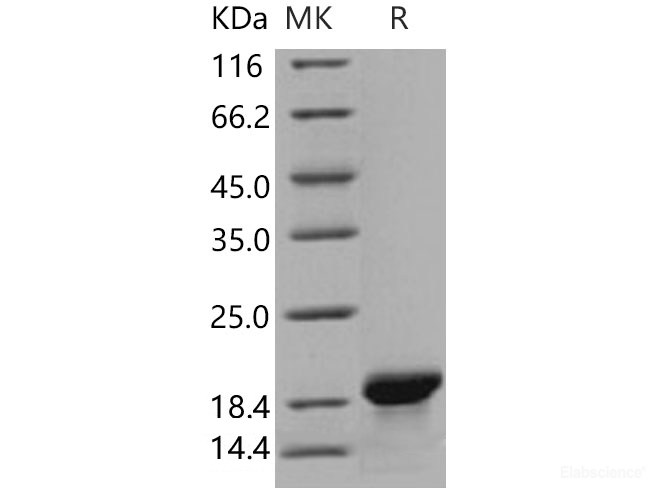 Recombinant Human MOG Protein (aa 30-149, His Tag)-Elabscience
