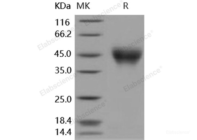 Recombinant Human IFNAR2 / IFNABR Protein (His tag)-Elabscience