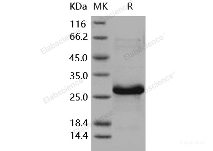 Recombinant Human HSP27 / HSPB1 Protein (His tag)-Elabscience