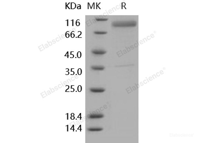 Recombinant Human IL13RA2 / IL13R Protein (His & Fc tag)-Elabscience