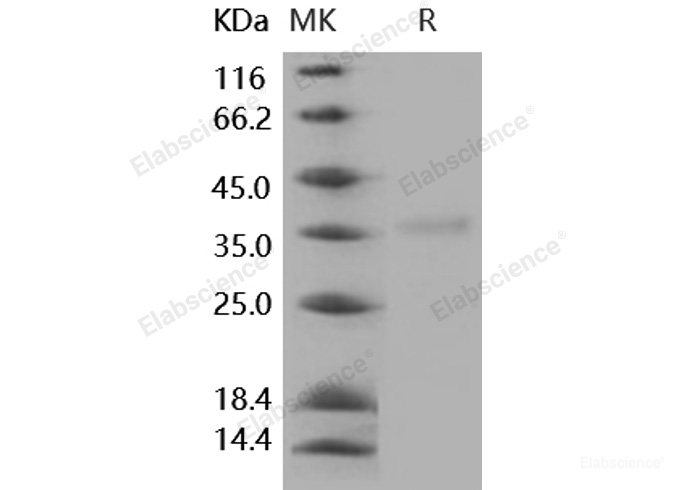 Recombinant Human Granzyme H Protein (His tag)-Elabscience