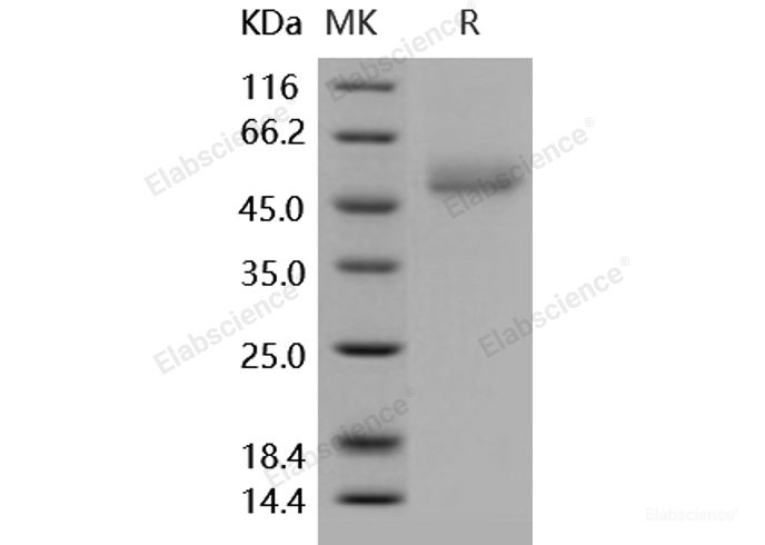 Recombinant Human ICOS / AILIM / CD278 Protein (His & Fc tag)-Elabscience
