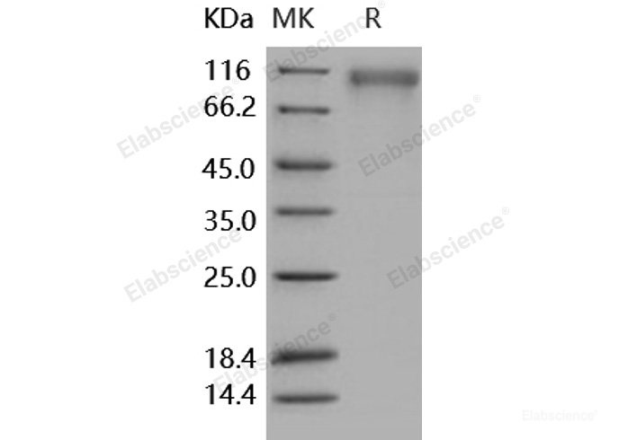 Recombinant Human SLITRK1 Protein (His tag)-Elabscience