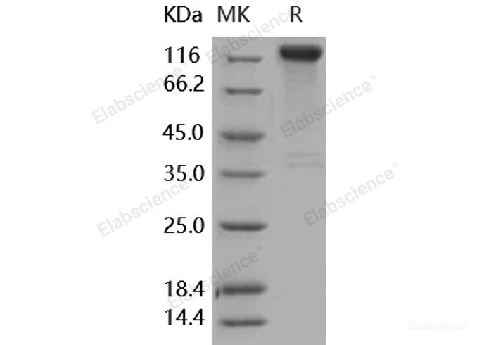 Recombinant Human SLITRK1 Protein (His & Fc tag)-Elabscience