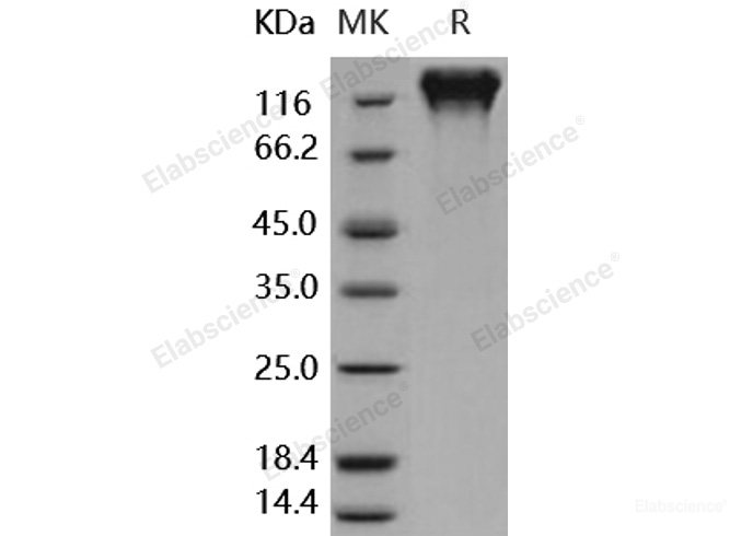 Recombinant Human CD50 / ICAM-3 Protein (His & Fc tag)-Elabscience