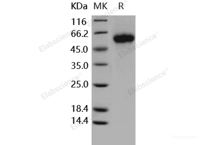 Recombinant Human GFRA1 / GFRα1 / GDNFRA Protein (His tag)-Elabscience