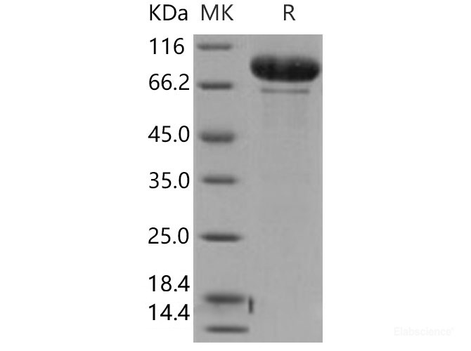 Recombinant Human MMP-9 Protein-Elabscience