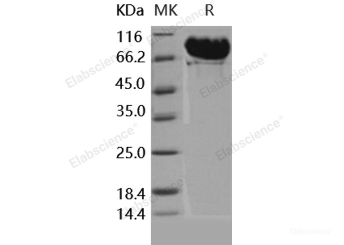 Recombinant Human MMP-9 / CLG4B Protein (His tag)-Elabscience