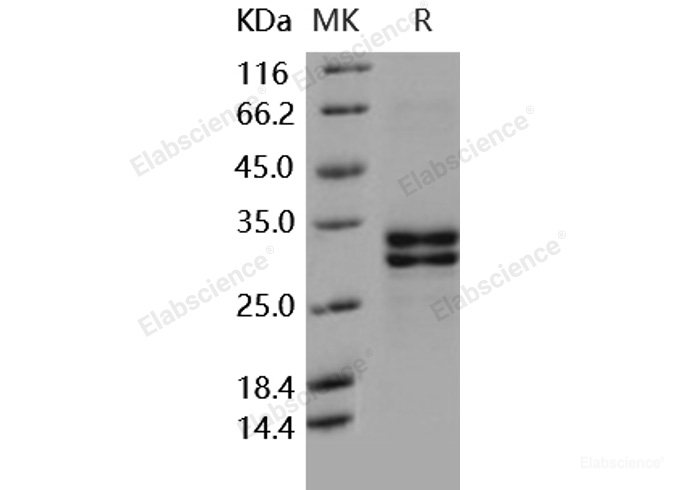 Recombinant Human HMGB1 / HMG1 Protein (His tag)-Elabscience