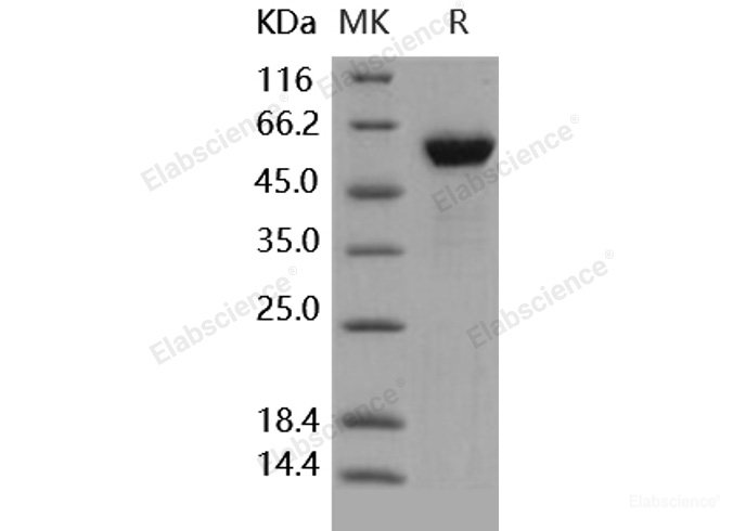 Recombinant Human HMGB1 / HMG1 Protein (Fc tag)-Elabscience