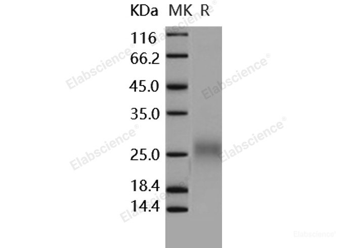 Recombinant Human FLT3L / Flt3 ligand / FLT3LG Protein (His tag)-Elabscience