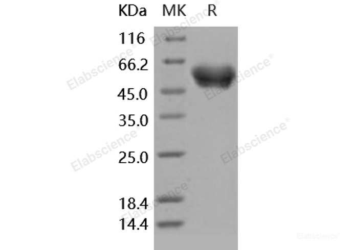Recombinant Human SerpinA1 / A1AT Protein (His tag)-Elabscience