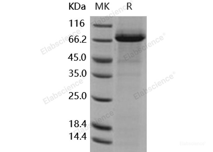 Recombinant Human Coagulation Factor XI / FXI / F11 Protein (His tag)-Elabscience