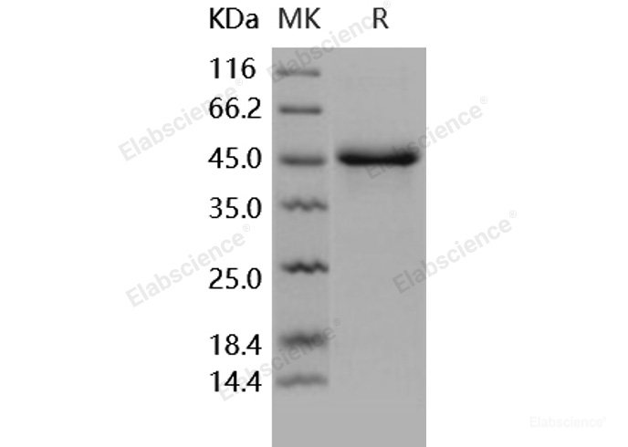 Recombinant Human SerpinE1 / PAI-1 Protein (His tag)-Elabscience