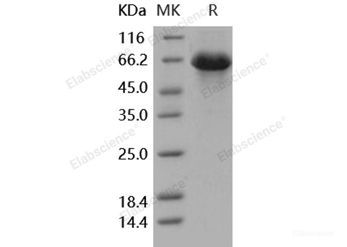 Recombinant Human SerpinD1 Protein (His tag)-Elabscience
