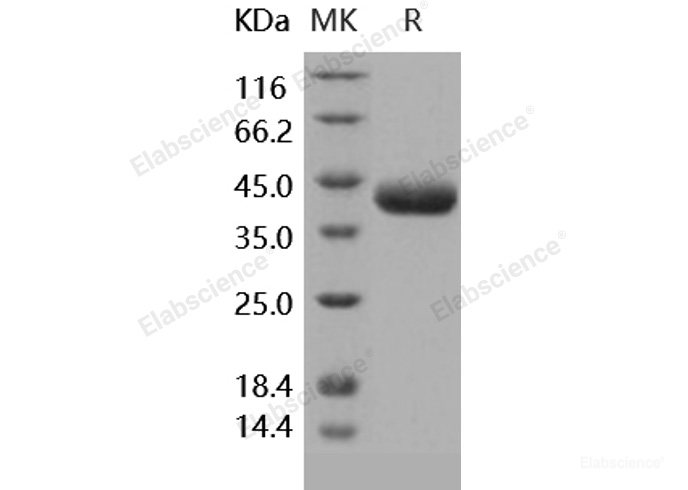 Recombinant Human Prostasin / Prss8 Protein (His tag)-Elabscience