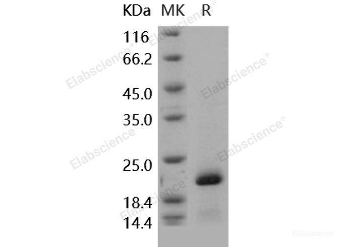 Recombinant Human PIN1 / Rotamase Pin1 Protein (His tag)-Elabscience