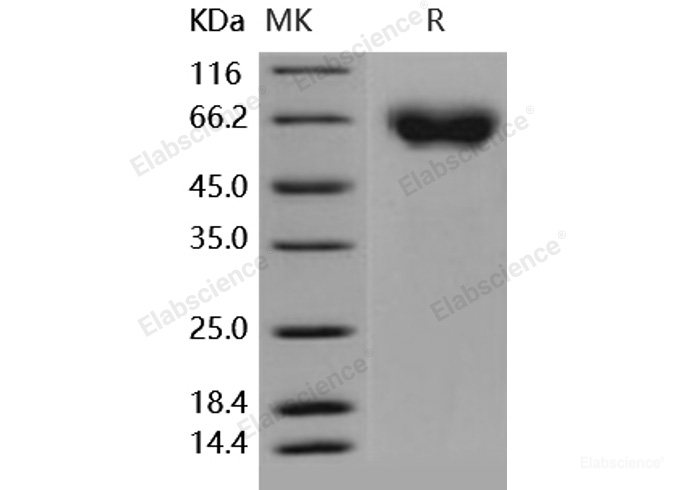 Recombinant Human Axl Kinase Protein (His tag)-Elabscience
