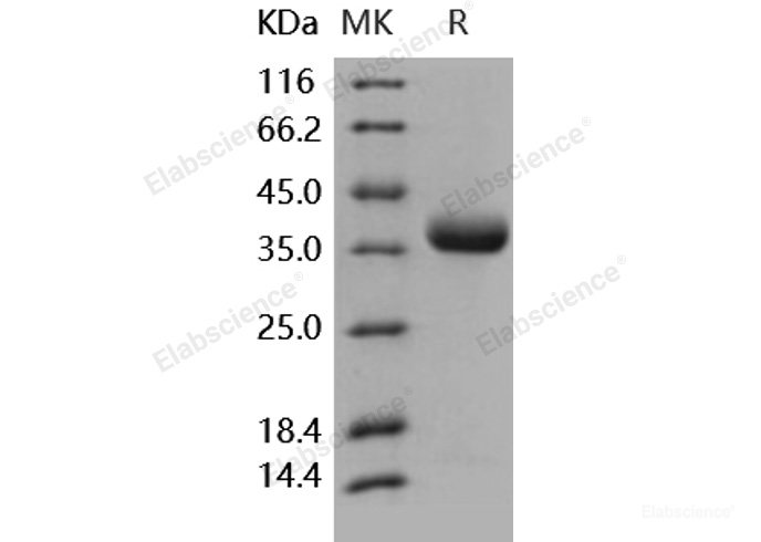 Recombinant Human PRLR / Prolactin Receptor Protein (His tag)-Elabscience
