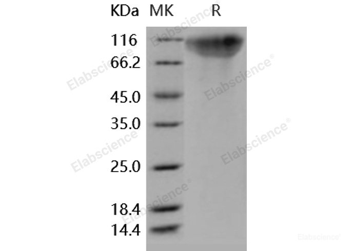 Recombinant Human OMGP / OMG Protein  (aa 1-420, His tag)-Elabscience
