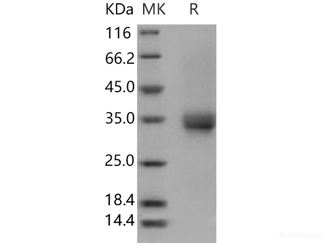 Recombinant Human CD32B Protein (His &AVI Tag), Biotinylated-Elabscience