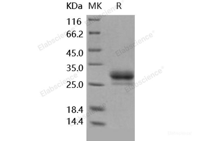 Recombinant Human CD32b / FCGR2B Protein (His tag)-Elabscience