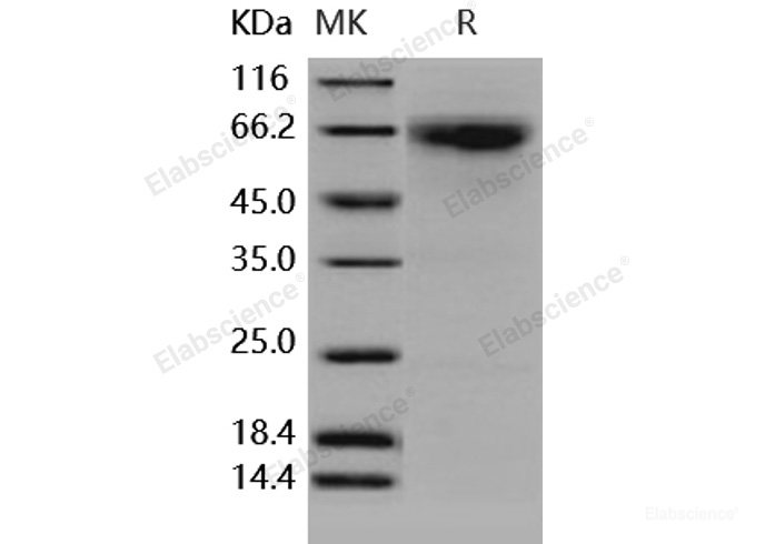 Recombinant Human MMP-8 / CLG1 Protein-Elabscience