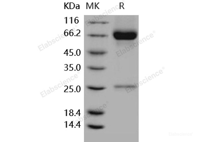 Recombinant Human MMP8 / CLG1 Protein (His tag)-Elabscience