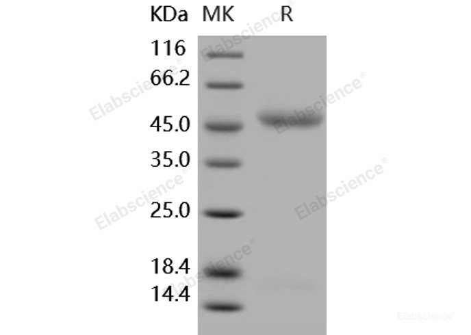 Recombinant Human IL11RA / IL11Rα Protein (His tag)-Elabscience
