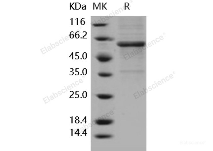 Recombinant Human METAP1 Protein (Fc tag)-Elabscience