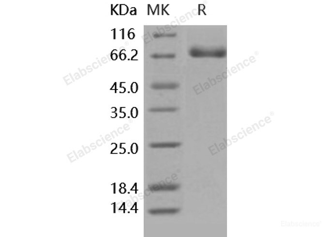 Recombinant Human EphB4 / HTK Protein (His tag)-Elabscience
