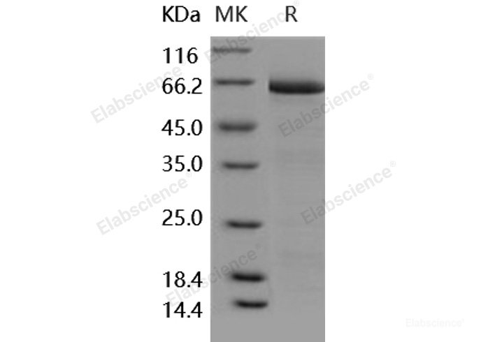Recombinant Human DCR3 / TNFRSF6B Protein (Fc tag)-Elabscience