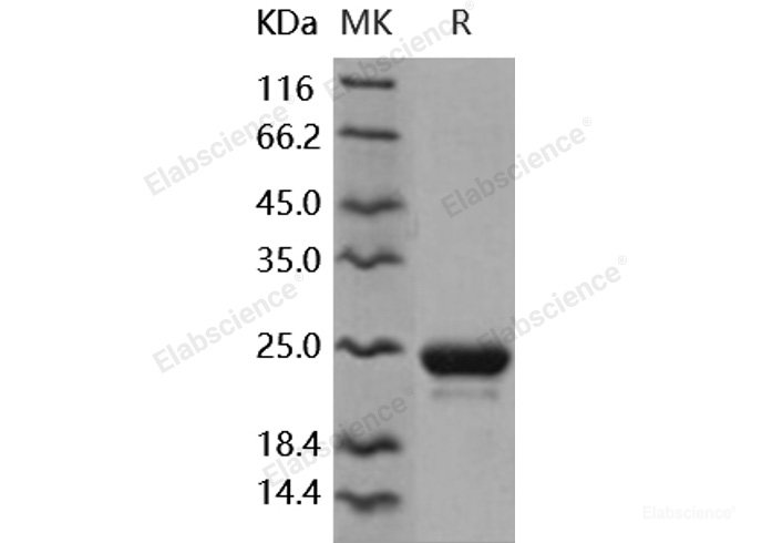 Recombinant Human LCN2 / NGAL Protein (His tag)-Elabscience