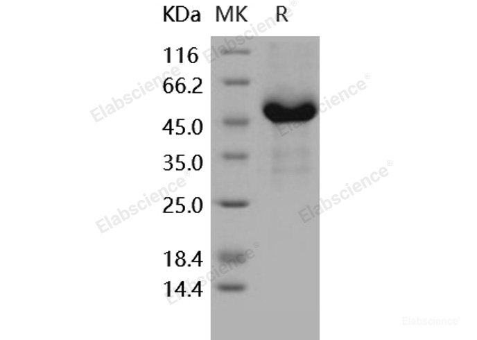 Recombinant Human GFRA3 / GFR-alpha-3 Protein (His tag)-Elabscience