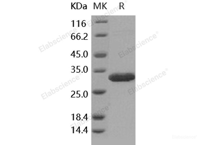 Recombinant Human Latexin / LXN / TCI Protein (His tag)-Elabscience