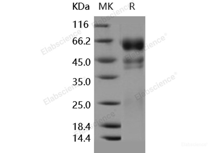 Recombinant Human PROC1 / Protein C / PROC Protein (His tag)-Elabscience