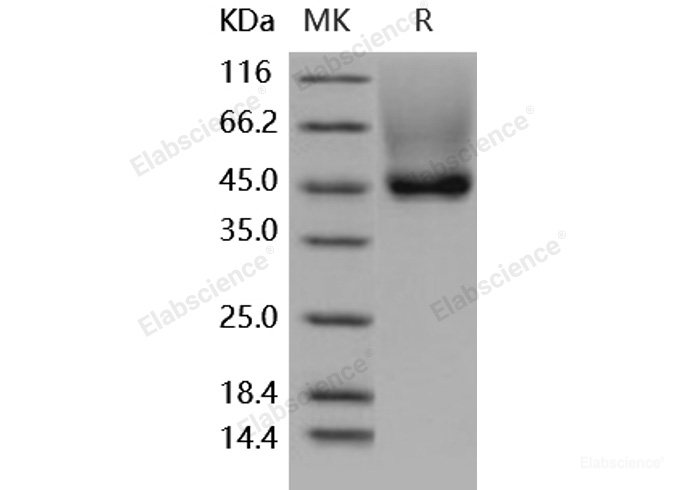 Recombinant Human Decorin / DCN / SLRR1B Protein (His tag)-Elabscience