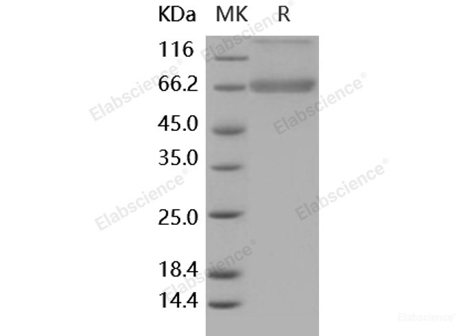 Recombinant Human Decorin / DCN / SLRR1B Protein (Fc tag)-Elabscience