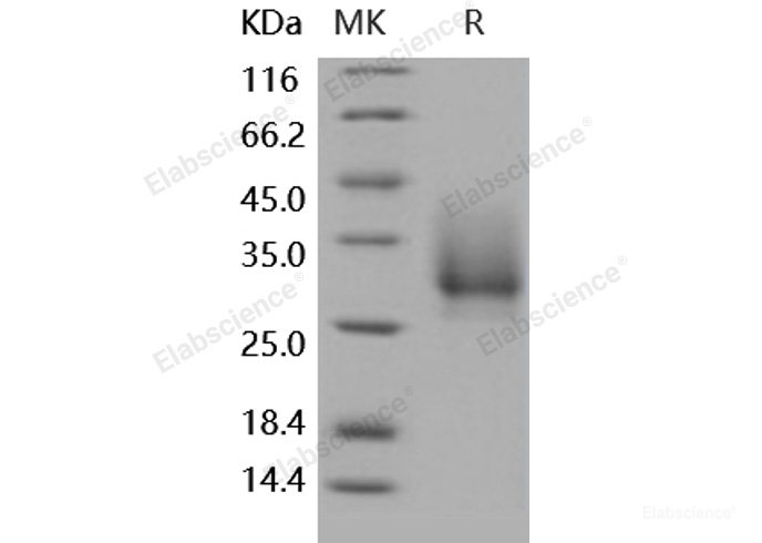 Recombinant Human CD147 / EMMPRIN / Basigin Protein (His tag)-Elabscience