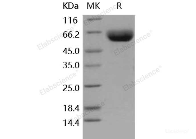 Recombinant Human CD147 / EMMPRIN / Basigin Protein (Fc tag)-Elabscience