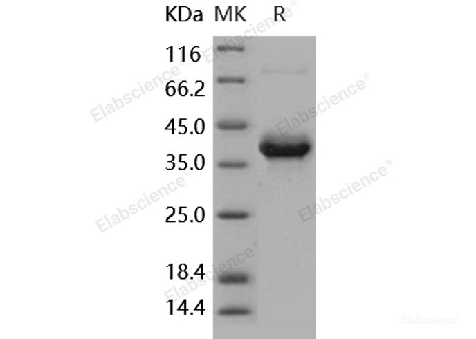 Recombinant Human S100A4 Protein (Fc tag)-Elabscience