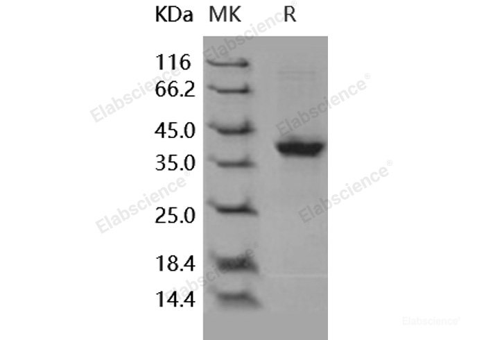 Recombinant Human S100A2 Protein (Fc tag)-Elabscience