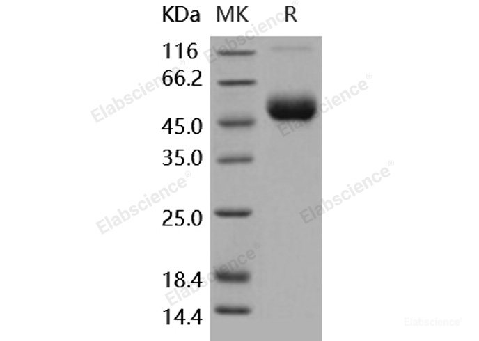 Recombinant Human IL-1R8 / IL1RAPL1 Protein (His tag)-Elabscience