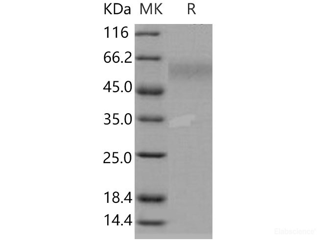 Recombinant Human DR6 Protein-Elabscience