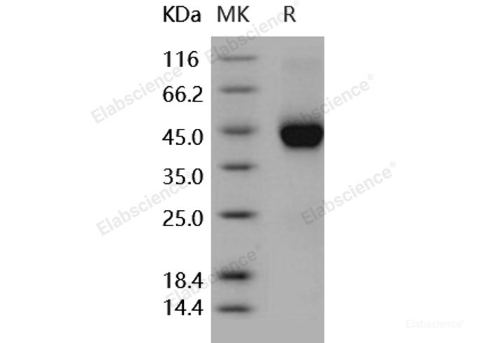 Recombinant Human Cystatin 7 / CST7 Protein (His tag)-Elabscience