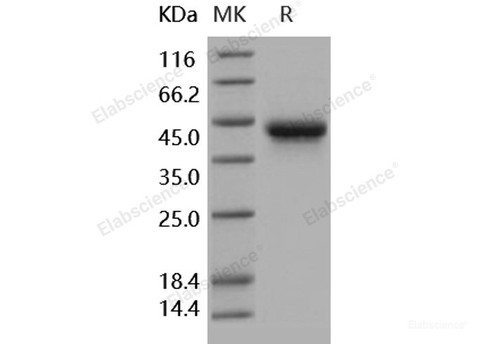 Recombinant Human IL2Ra / CD25 Protein (His tag)-Elabscience