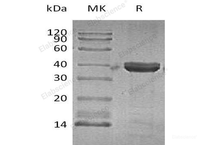 Recombinant Human Cathepsin Z Protein (His Tag)-Elabscience