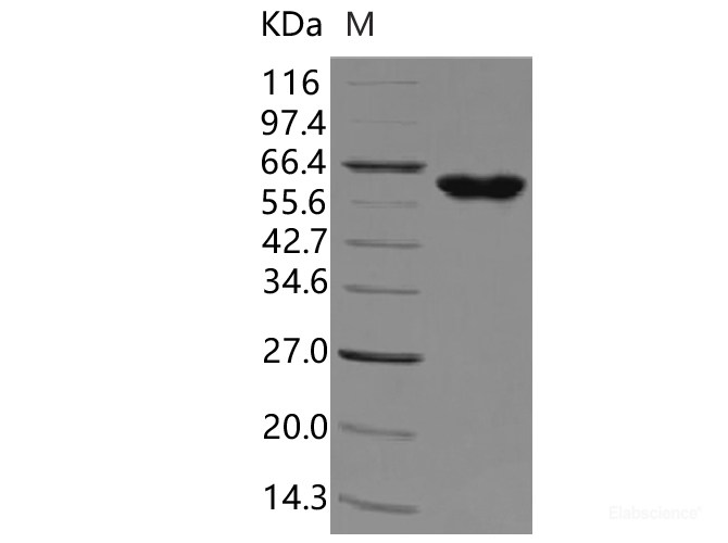 Recombinant Human tPA / PLAT Protein (Fc tag)-Elabscience