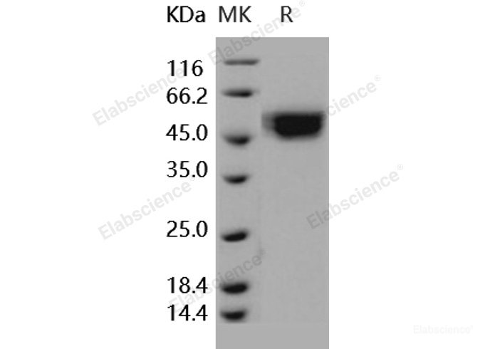 Recombinant Human IL-1R9 / IL1RAPL2 Protein (His tag)-Elabscience